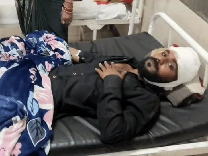 उज्जैन: होटलकर्मी पर चार युवकों ने चाकू से किए वार, सिर-पैर में गंभीर चोटें