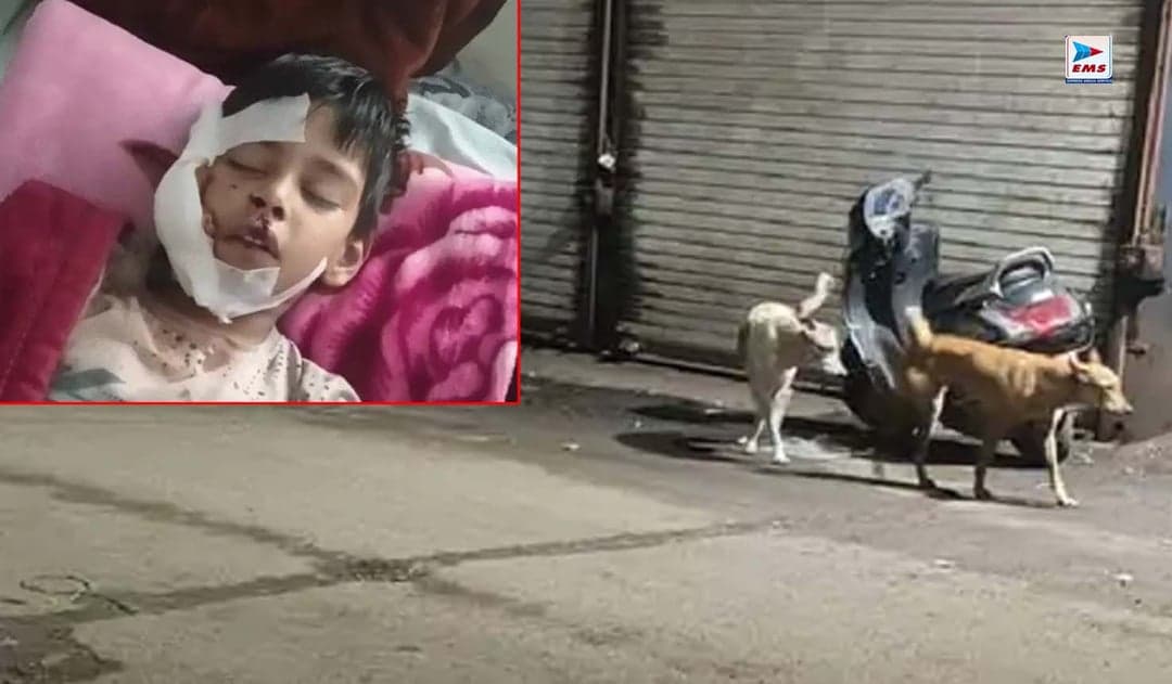 भोपाल: 8 साल के मासूम पर घर में घुसकर कुत्ते का हमला, चेहरे पर गंभीर घाव