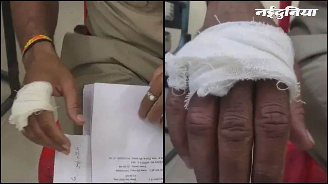 उज्जैन में पुलिस पर हमला: शराब पी रहे युवकों को टोकना पड़ा भारी, कॉन्स्टेबल की कटी उंगली, 3 गिरफ्तार